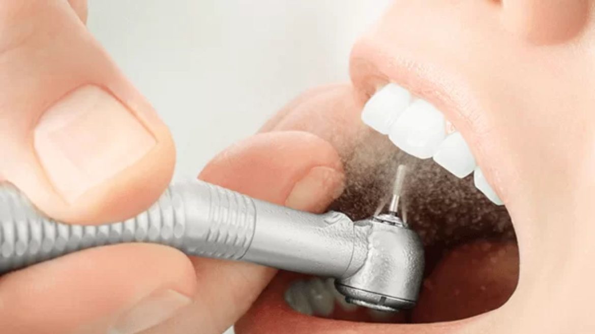 Nha khoa cạo vôi răng uy tín tại Quận 1