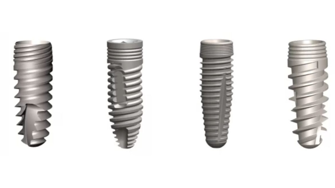 Trồng răng implant loại nào tốt