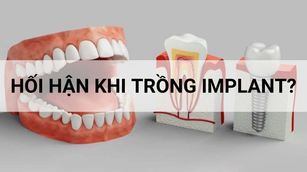 hối hận khi trồng implant