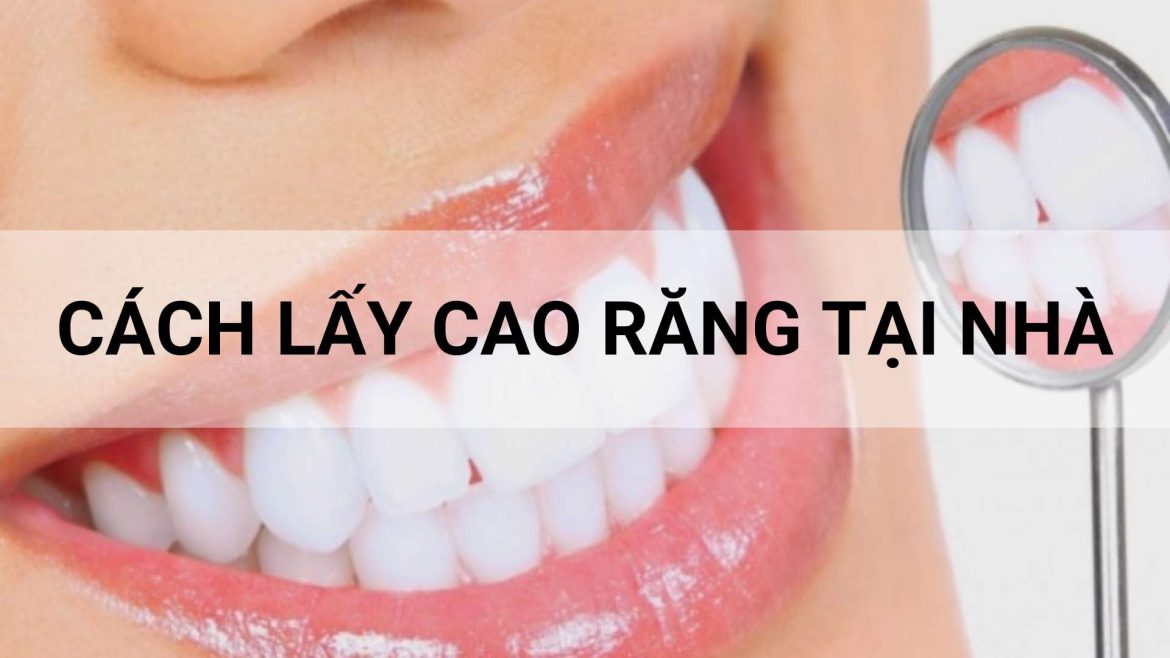 lấy cao răng tại nhà