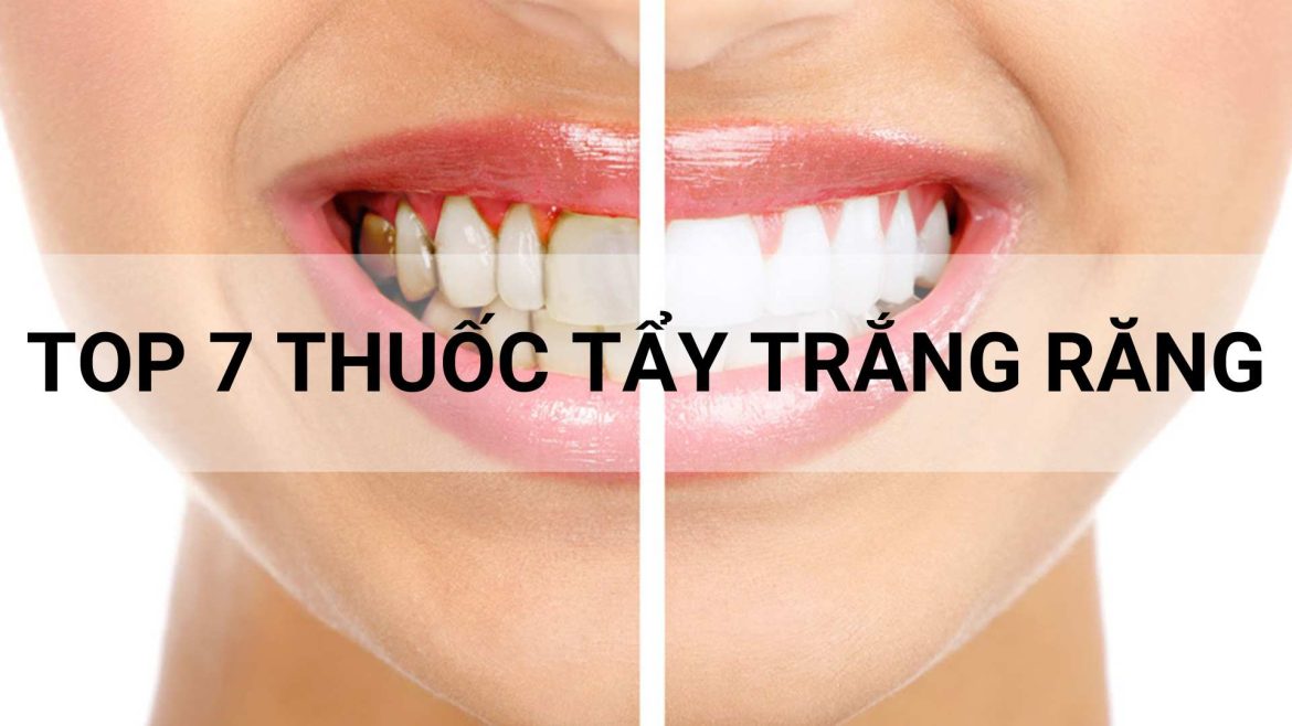 thuốc tẩy trắng răng