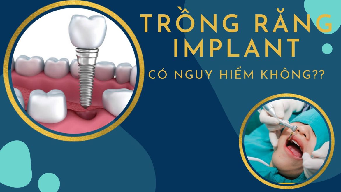 Trồng răng implant có nguy hiểm không -1
