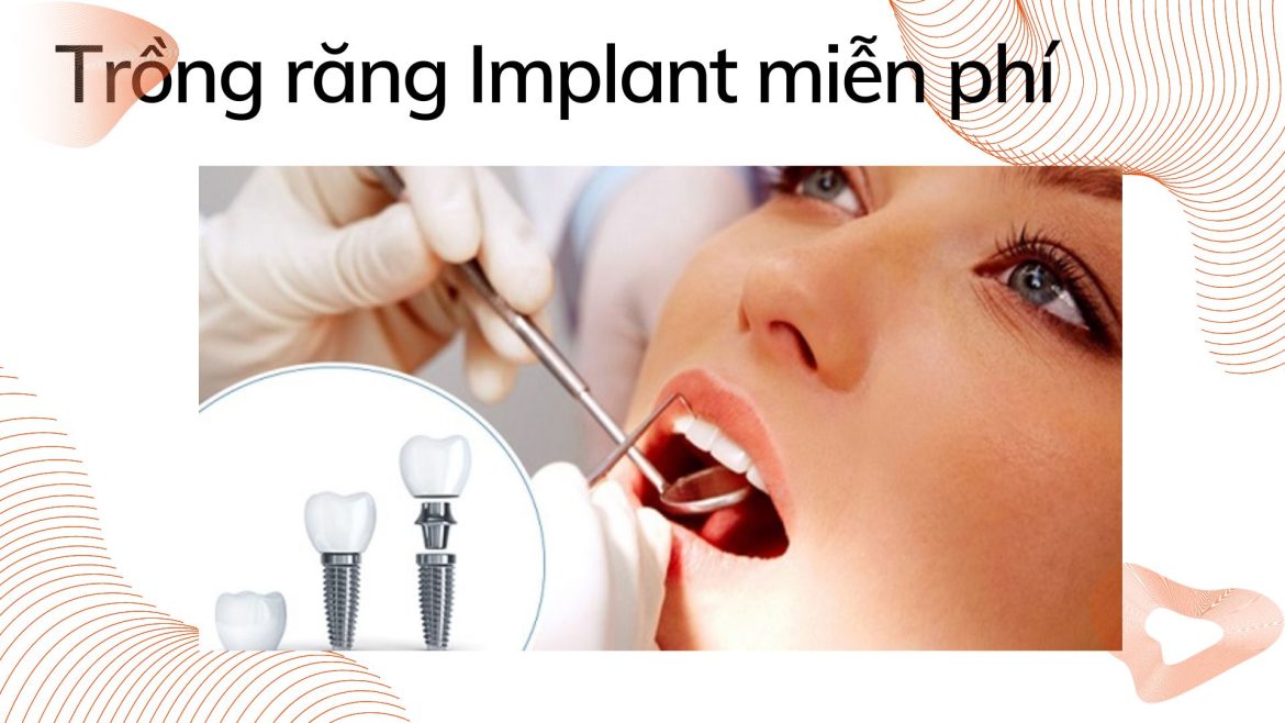 Trồng răng implant miễn phí - 1