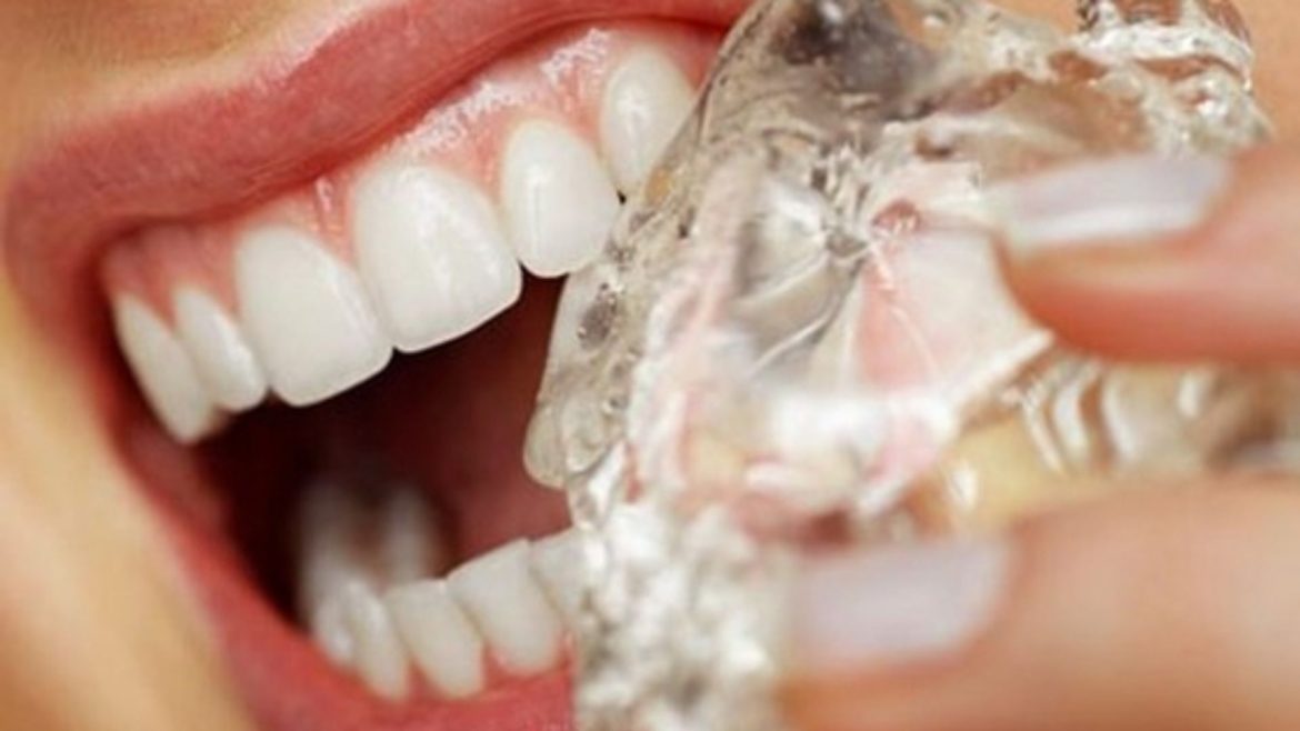 cách giảm đau răng -8