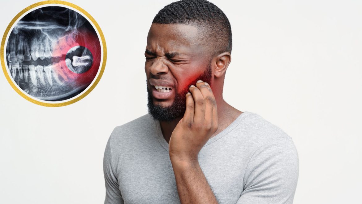 Đau răng khôn - 1