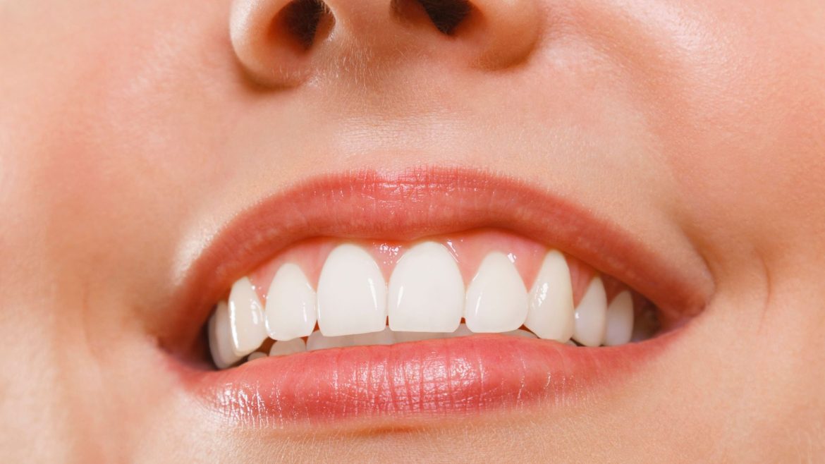 Hàm răng đẹp -1