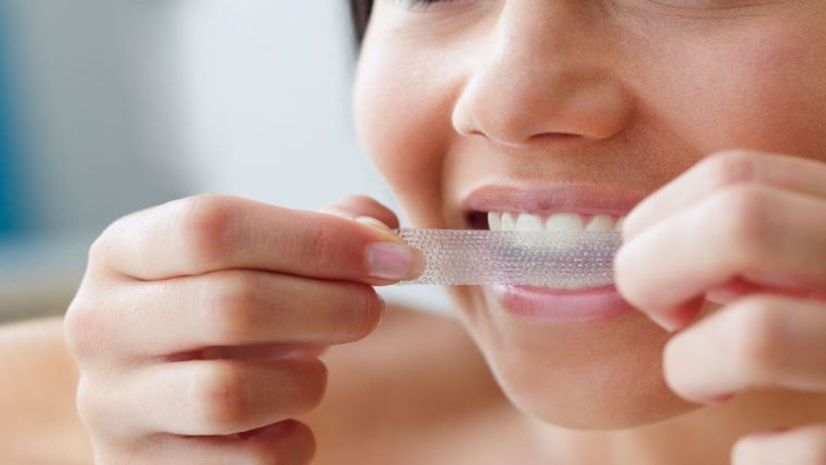 Miếng dán trắng răng -1