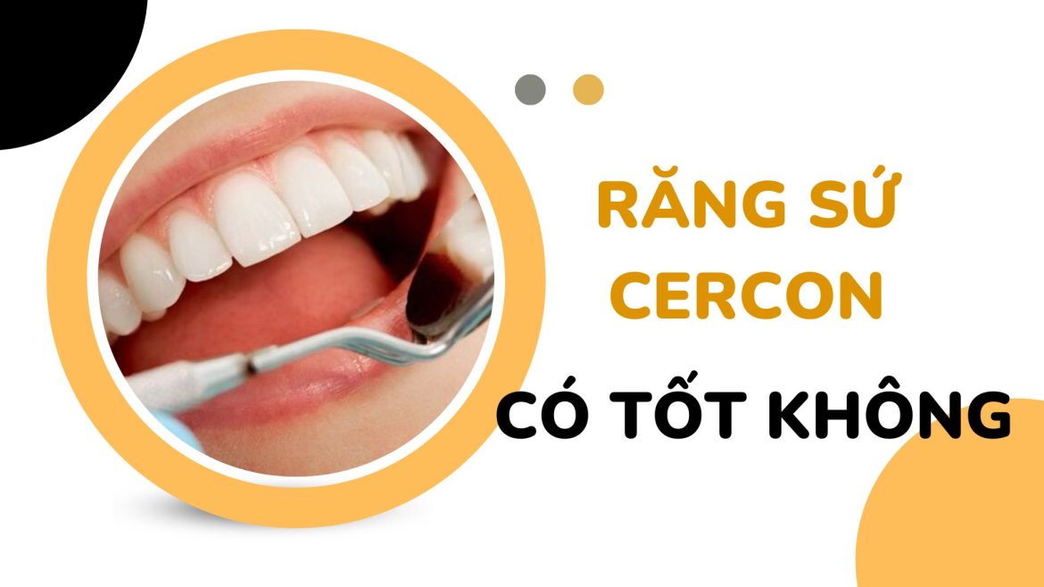 Răng sứ Cercon -1